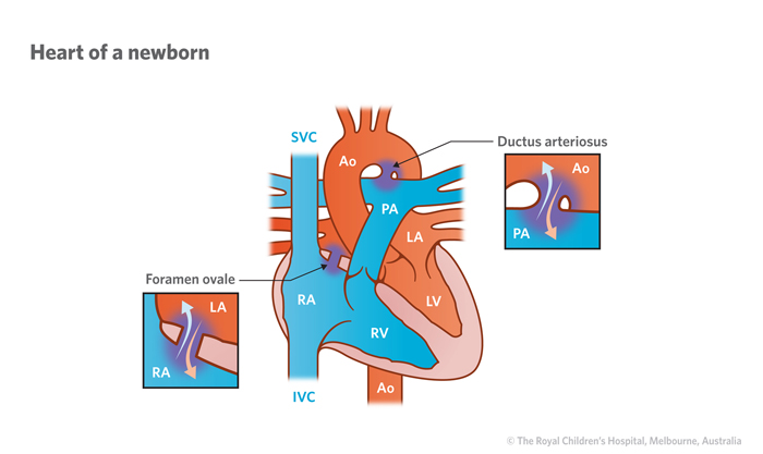 Illustration of a newborn heart and circulation