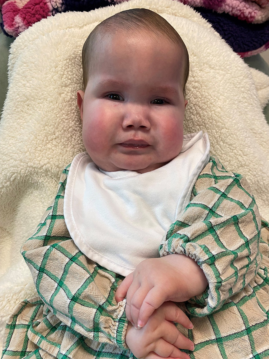 Haven was diagnosed with Schaaf-Yang Syndrome at one month old