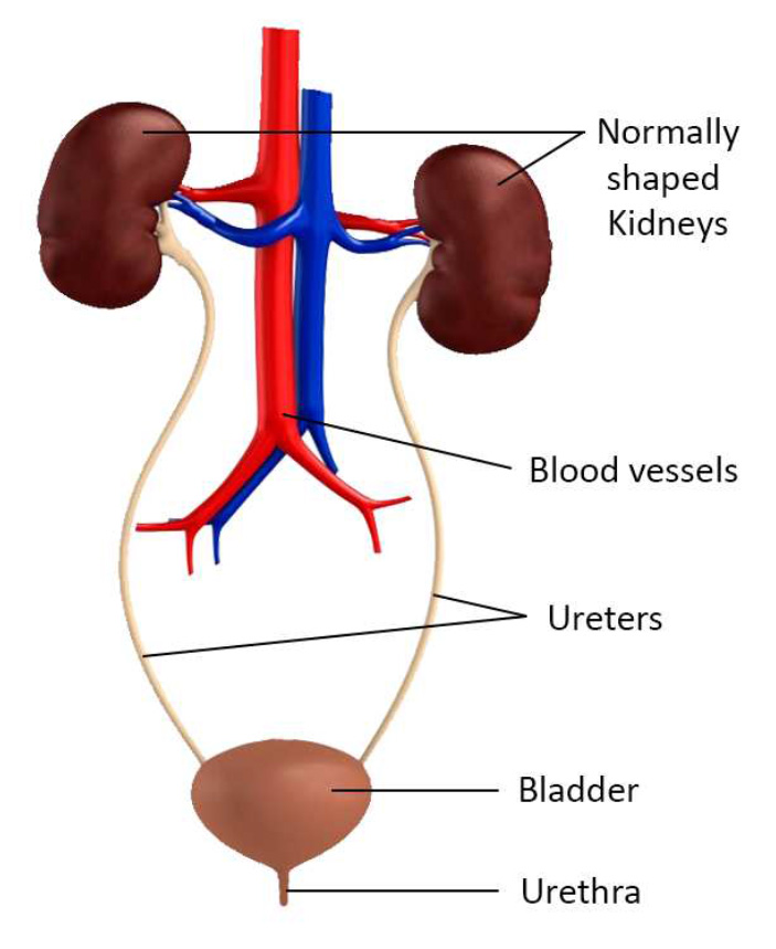 Normally shaped kidneys, blood vessels, ureters, bladder, urethra